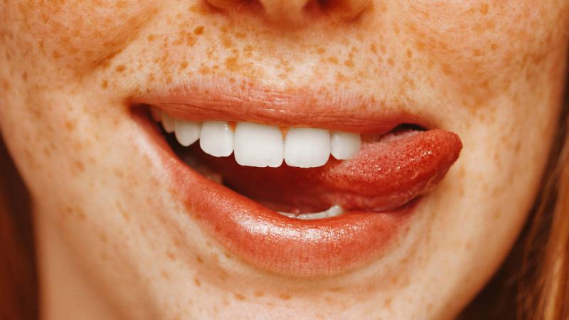 Puntos rojos en la lengua: posibles causas y tratamientos naturales