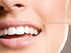 Implantes Dentales Bariloche