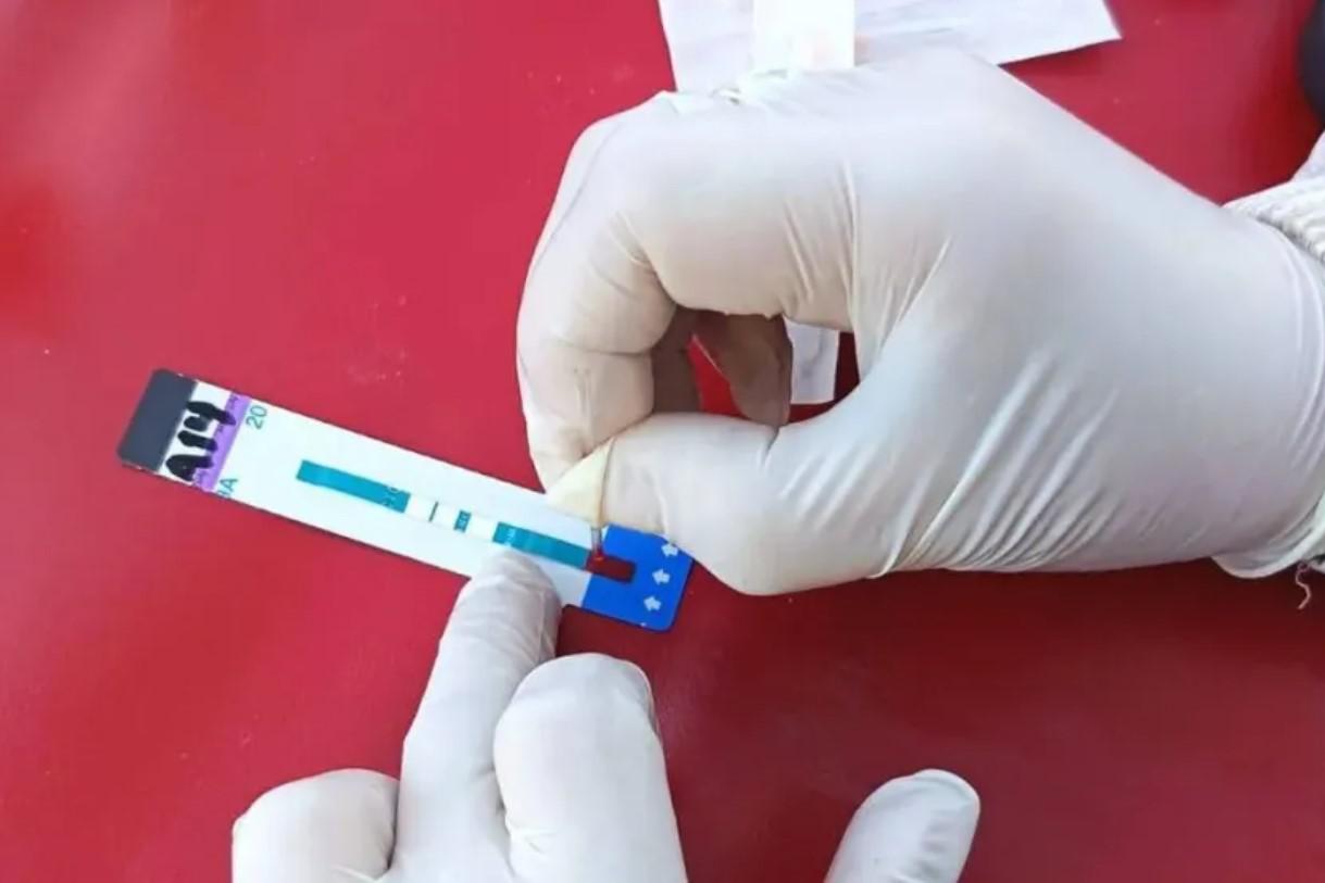 D&iacute;a Mundial del VIH: hacete el test gratis y de forma confidencial